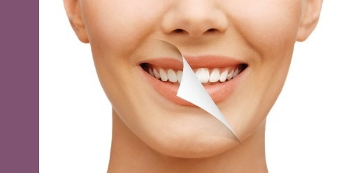 Do You Want to Enhance Your Natural Smile? Dental Rooms Offers Tips on Cosmetic Dental Treatments