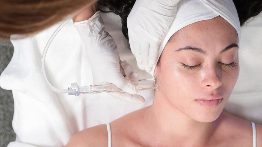 HydraFacial-treament-Nakedhealth-Medispa-Wimbledon-