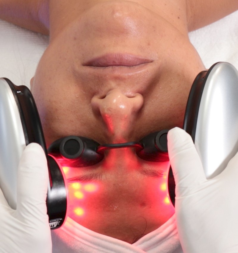 HydraFacial-treatment-Nakedhealth-Medispa-Wimbledon